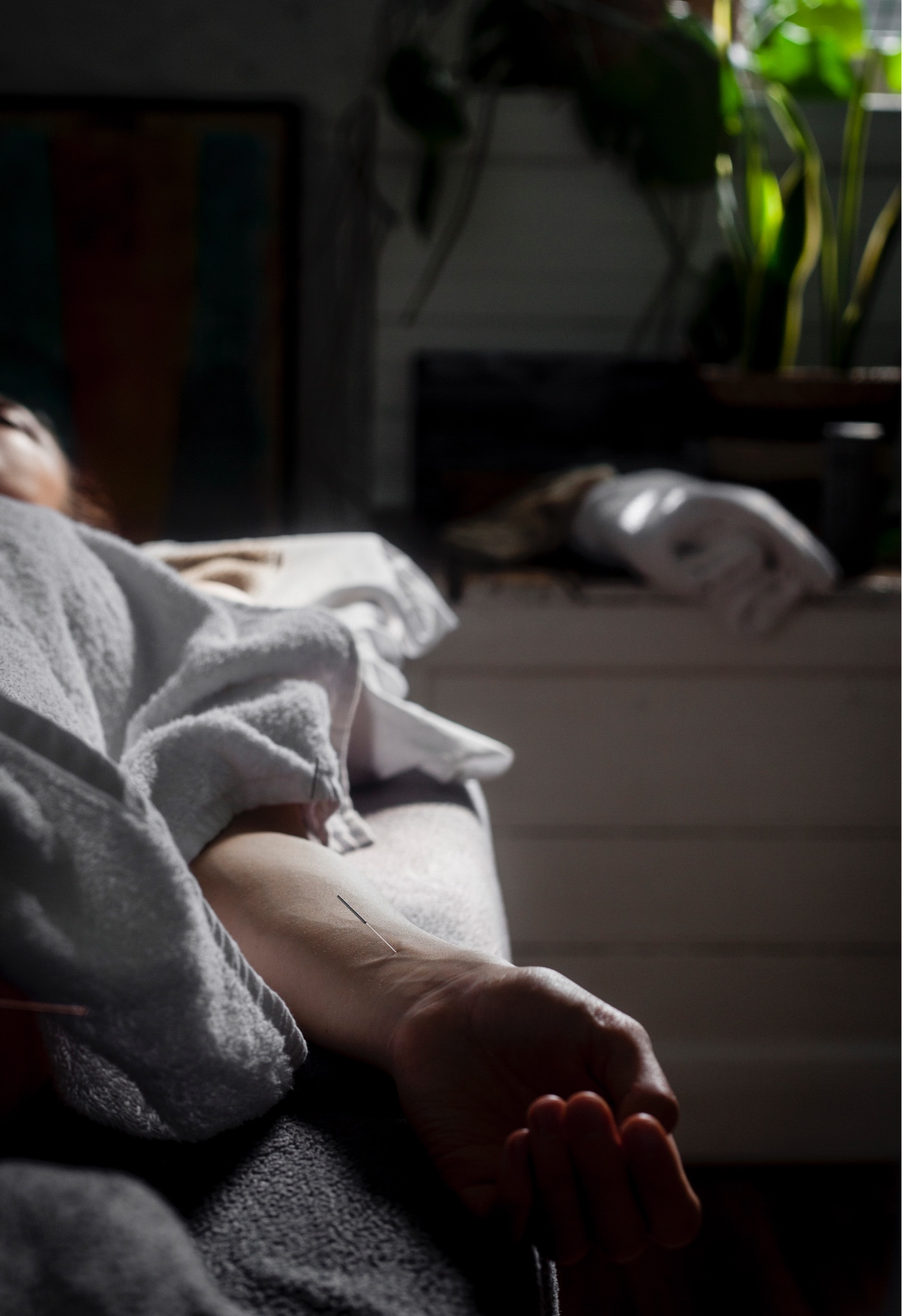 East of West applying pain relief through acupuncture in the Adelaide treatment room