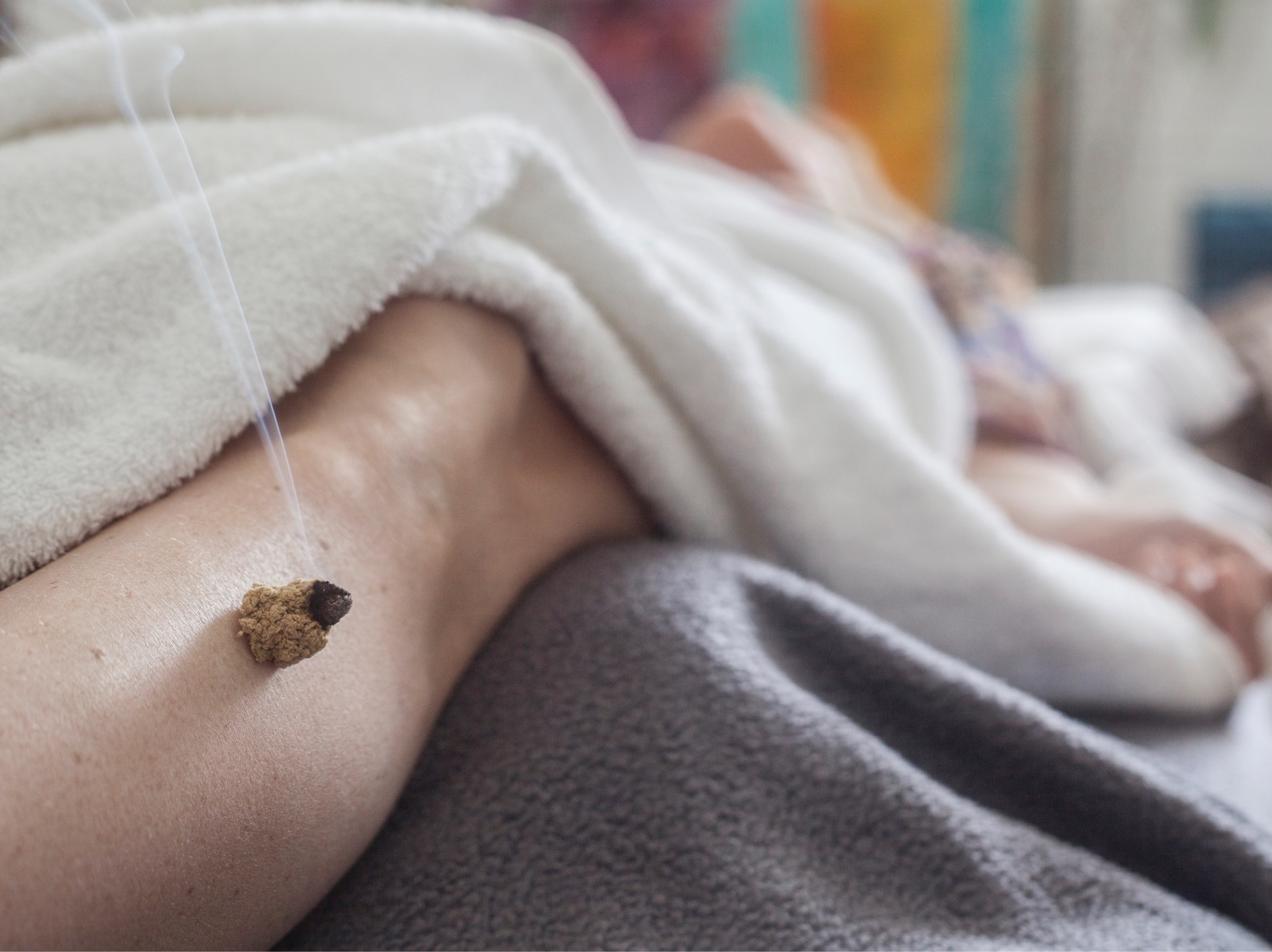 East of West burning moxibustion on the body for pain relief.