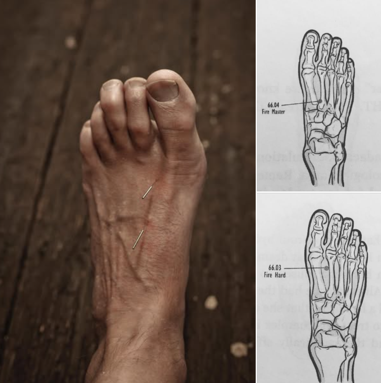 book natural medicine, acupuncture on foot.